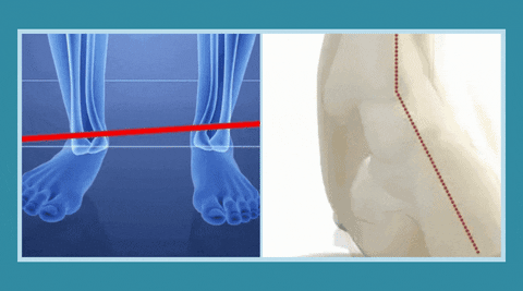 ComfortLoafers™ Orthopedic Women’s Support Shoes